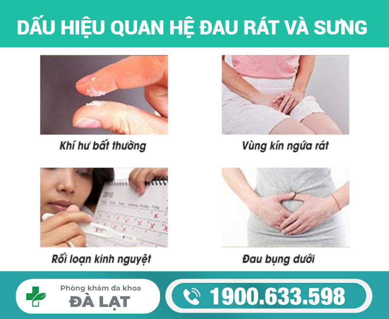 Hình ảnh minh họa